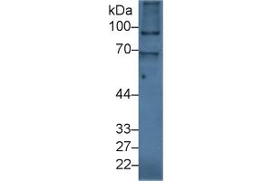 Detection of ITIH2 in Human Liver lysate using Polyclonal Antibody to Inter Alpha-Globulin Inhibitor H2 (ITIH2)