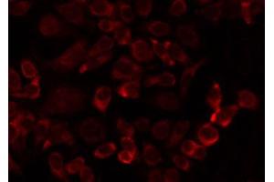 ABIN6274737 staining HuvEc by IF/ICC. (MRPL24 anticorps  (Internal Region))