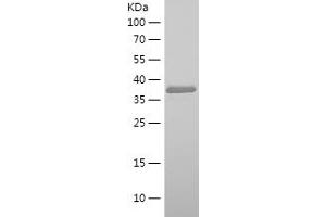 Western Blotting (WB) image for Neuregulin 1 (NRG1) (AA 119-237) protein (His-IF2DI Tag) (ABIN7124139)