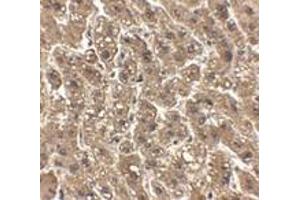 Immunohistochemistry of erbB-2 in human liver tissue with erbB-2 antibody at 2. (ErbB2/Her2 anticorps  (C-Term))
