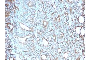 Formalin-fixed, paraffin-embedded human Colon stained with Cadherin 17 / CDH17 Mouse Monoclonal Antibody (CDH17/2617).