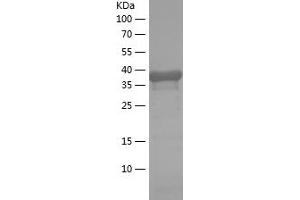 Western Blotting (WB) image for Calbindin 2 (CALB2) (AA 1-159) protein (His-IF2DI Tag) (ABIN7122075)