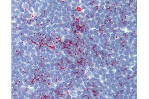 Anti-SENP1 antibody IHC of human thymus. (SENP1 anticorps  (AA 28-59))
