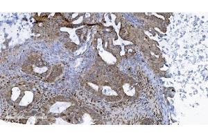 IHC analysis of SAMHD1 using anti-SAMHD1 antibody (ABIN7601514).