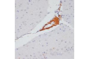 Immunohistochemistry of paraffin-embedded mouse brain using Phospho-ACLY-S455 antibody (ABIN6135178, ABIN6136002, ABIN6136003 and ABIN6225678) at dilution of 1:100 (40x lens).