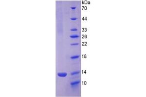 SDS-PAGE of Protein Standard from the Kit  (Highly purified E.
