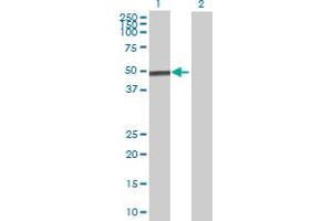 Lane 1: MICB transfected lysate ( 37.