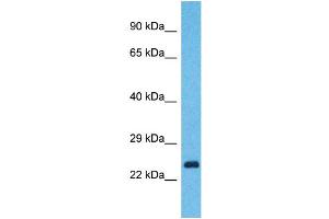 Western Blotting (WB) image for anti-Yip1 Domain Family, Member 7 (YIPF7) (N-Term) antibody (ABIN2791993) (YIPF7 anticorps  (N-Term))