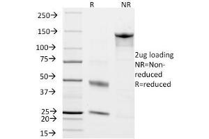 SDS-PAGE Analysis Purified Chromogranin A Monoclonal Antibody (CHGA/798). (Chromogranin A anticorps)