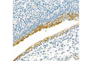 Immunohistochemistry of paraffin embedded mouse embryonic mouse using IFIT5 (ABIN7074334) at dilution of 1:300 (300x lens) (IFIT5 anticorps)