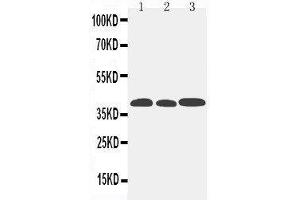 Anti-CCR5 antibody,  Western blotting Lane 1: Mouse Lung Tissue Lysate Lane 2: Mouse Intestine Tissue Lysate Lane 3: Mouse Kidney Tissue Lysate