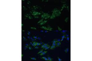 Immunofluorescence analysis of C6 cells using EPH antibody (ABIN6132064, ABIN6140215, ABIN6140216 and ABIN6224369) at dilution of 1:100. (EPH Receptor A4 anticorps  (AA 887-986))