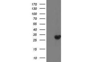 Western Blotting (WB) image for anti-Deoxythymidylate Kinase (Thymidylate Kinase) (DTYMK) antibody (ABIN1497919) (DTYMK anticorps)