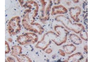 Detection of CPB2 in Human Kidney Tissue using Polyclonal Antibody to Carboxypeptidase B2 (CPB2)