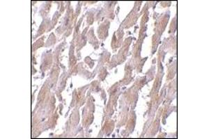 Immunohistochemistry (IHC) image for anti-Myeloid Differentiation Primary Response Gene (88) (MYD88) (AA 176-280) antibody (ABIN492527) (MYD88 anticorps  (AA 176-280))