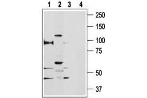 Western blot analysis of rat kidney (lanes 1 and 3) and human PC3 prostate cancer cell line (lanes 2 and 4) lysates: - 1,2.