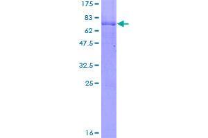 Image no. 1 for Parkinson Protein 2, E3 Ubiquitin Protein Ligase (Parkin) (PARK2) (AA 1-387) protein (GST tag) (ABIN1314008)