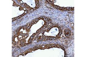 IHC analysis of TOMM40 using anti-TOMM40 antibody (ABIN7599738).