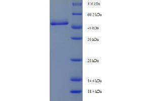 SDS-PAGE (SDS) image for Cathepsin D (CTSD) (AA 65-408), (partial) protein (His-SUMO Tag) (ABIN5709355)