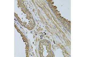 Immunohistochemistry of paraffin-embedded human prostate using MYLIP antibody (ABIN2737207) at dilution of 1:100 (40x lens). (MYLIP anticorps)