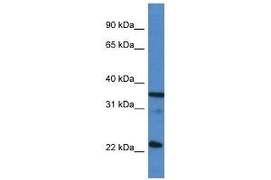 Western Blot showing SFRS2 antibody used at a concentration of 1 ug/ml against Hela Cell Lysate (SRSF2 anticorps  (C-Term))