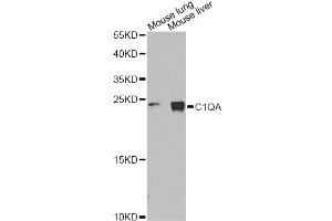 Western blot analysis of extracts of various cell lines, using C1QA Antibody (ABIN1875415) at 1:1000 dilution. (C1QA anticorps)