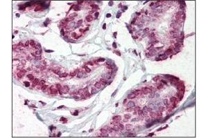 Immunohistochemistry (IHC) image for anti-CD44 (CD44) (AA 21-145) antibody (ABIN263995)