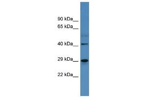 Western Blotting (WB) image for anti-Carbonic Anhydrase II (CA2) (C-Term) antibody (ABIN617259) (CA2 anticorps  (C-Term))