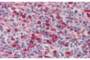 Detection of PLA2G2D in Human Spleen Tissue using Polyclonal Antibody to Phospholipase A2, Group IID (PLA2G2D)