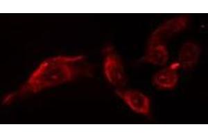 ABIN6279907 staining  Hela cells by IF/ICC.