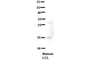 WB Suggested Anti-C21orf2 Antibody Titration:  5% Milk  ELISA Titer:  dilution: 1:500  Positive Control:  human LCL