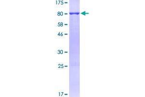 Image no. 1 for Beclin 1, Autophagy Related (BECN1) (AA 1-450) protein (GST tag) (ABIN1346622)