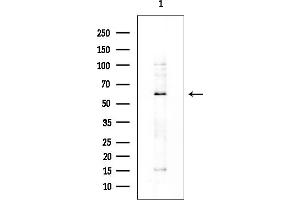 Western blot analysis of lysates from COLO205 cells, using IGFALS Antibody at 1/1000 dilution.