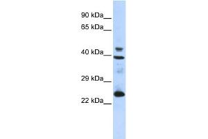 WB Suggested Anti-SEPP1 Antibody Titration: 0. (Selenoprotein P anticorps  (N-Term))