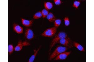 anti-Centriolar Coiled Coil Protein 110kDa (CCP110) (AA 51-284) antibody