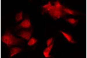 ABIN6274286 staining HT29 by IF/ICC. (DGKQ anticorps  (C-Term))