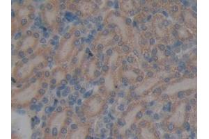 DAB staining on IHC-P; Samples: Rat Kidney Tissue (GALNS anticorps  (AA 172-381))