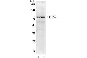 Western Blotting (WB) image for anti-Metastasis Associated 1 Family, Member 2 (MTA2) (AA 500-550) antibody (ABIN7449600)