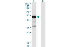 Western Blot analysis of TARBP2 expression in transfected 293T cell line by TARBP2 monoclonal antibody (M03), clone 1D9.