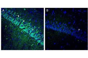 Expression of OCTN1 in rat hippocampus. (SLC22A4 anticorps  (C-Term, Intracellular))
