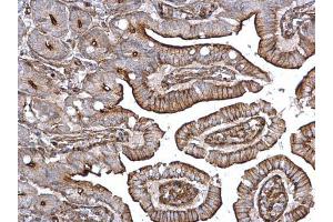 IHC-P Image alpha Actinin 4 antibody [C2C3], C-term detects alpha Actinin 4 protein on mouse intestine by immunohistochemical analysis.