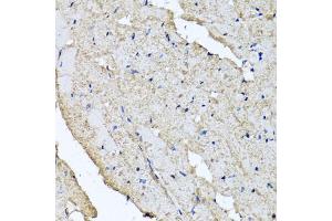 Immunohistochemistry of paraffin-embedded rat heart using USH1C antibody (ABIN5972448) at dilution of 1/100 (40x lens). (USH1C anticorps)