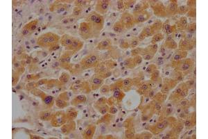 IHC image of ABIN7153713 diluted at 1:100 and staining in paraffin-embedded human liver tissue performed on a Leica BondTM system. (Glucose-6-Phosphate Dehydrogenase anticorps  (AA 422-712))