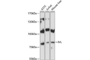 Western blot analysis of extracts of various cell lines, using IVL antibody (ABIN6128143, ABIN6142620, ABIN6142621 and ABIN6224048) at 1:3000 dilution.