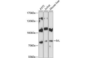 Western blot analysis of extracts of various cell lines, using IVL antibody (ABIN6128143, ABIN6142620, ABIN6142621 and ABIN6224048) at 1:3000 dilution. (Involucrin anticorps  (AA 416-585))