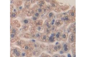 Figure. (alpha 2 Macroglobulin anticorps  (AA 911-1042))