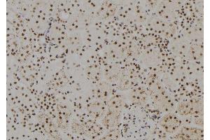 ABIN6279425 at 1/100 staining Rat kidney tissue by IHC-P. (FANCM anticorps  (Internal Region))