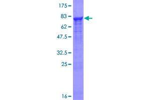 Image no. 1 for Pre-mRNA Processing Factor 19 (PRPF19) (AA 1-504) protein (GST tag) (ABIN1316383)