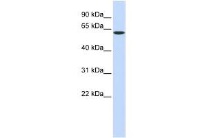 WB Suggested Anti-SPTLC1 Antibody Titration:  0. (SPTLC1 anticorps  (Middle Region))