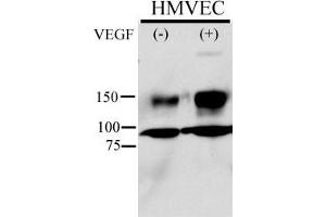 Anti-Phospho-KDR/FLK1- Pab (ABIN389564 and ABIN2839596) is used in Western blot to detect Phospho-KDR/FLK1- in HMVEC cell line lysate. (VEGFR2/CD309 anticorps  (pTyr996))